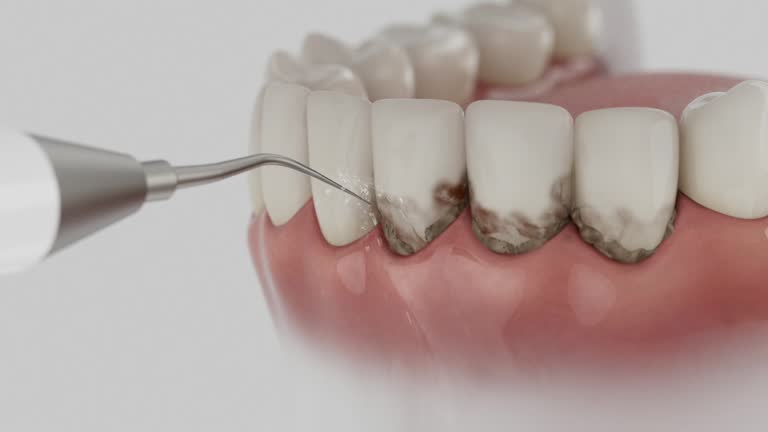 Reliable Dental contractor in Tracy, MN by Smile Center Dentistry